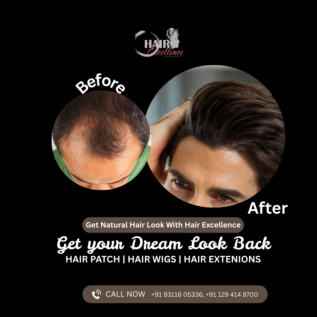Hair Wig Shop In Faridabad