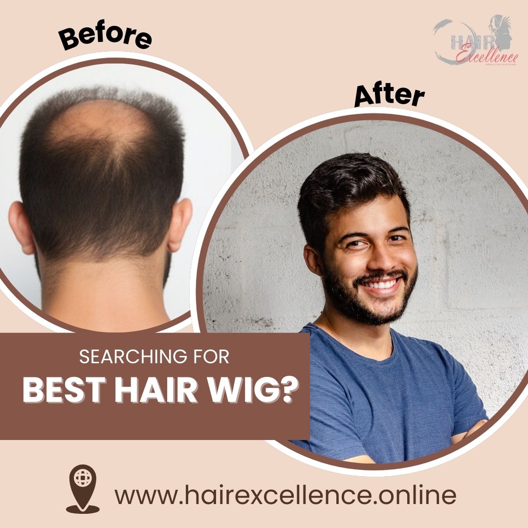 Best Hair Wig Clinic In Faridabad
