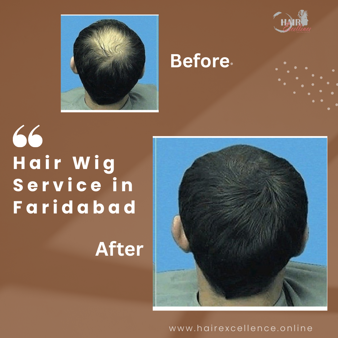 Top Benefits of Choosing Hair Wig Service in Faridabad